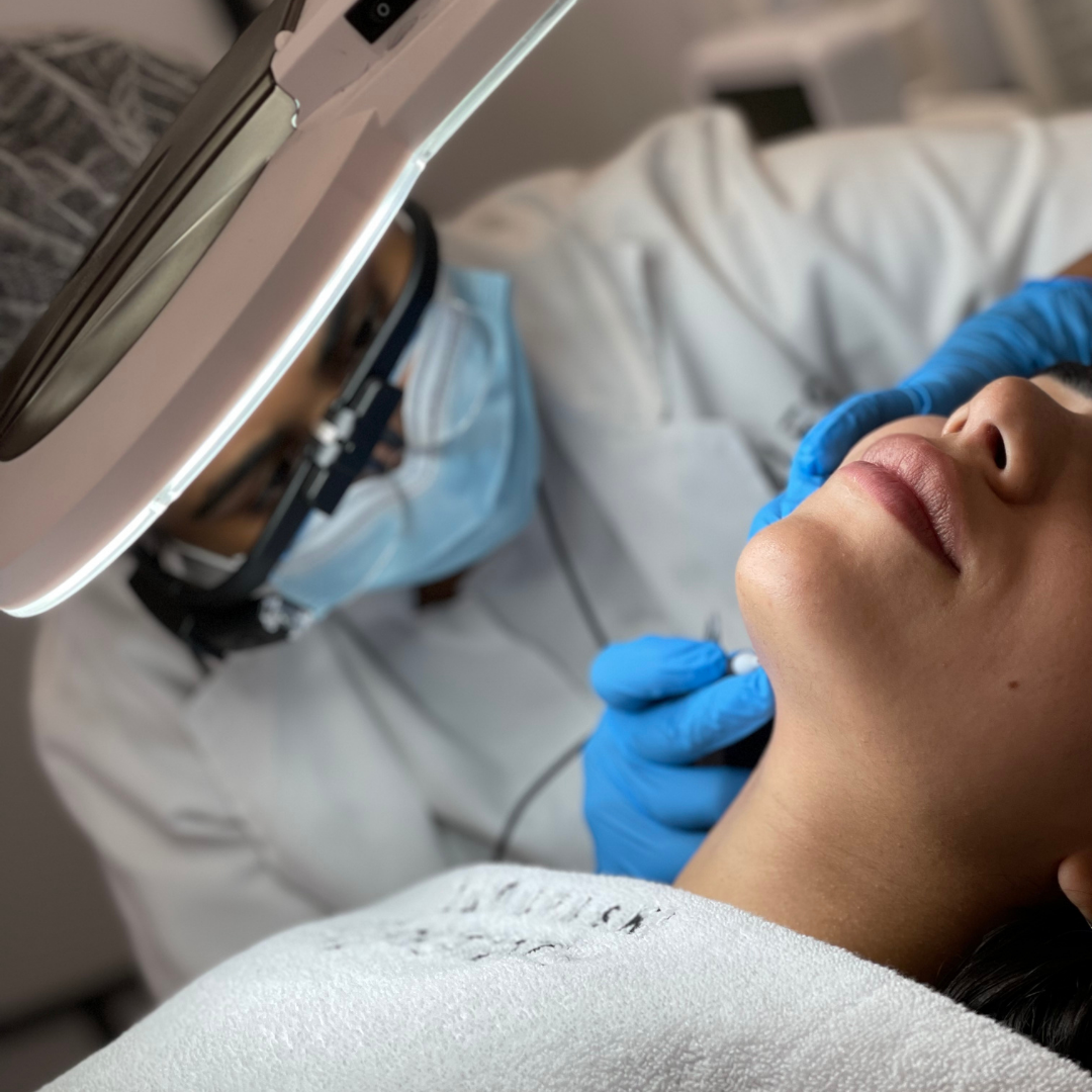 Female electrologist performing electrolysis on the chin of a female client at Furless Permanent