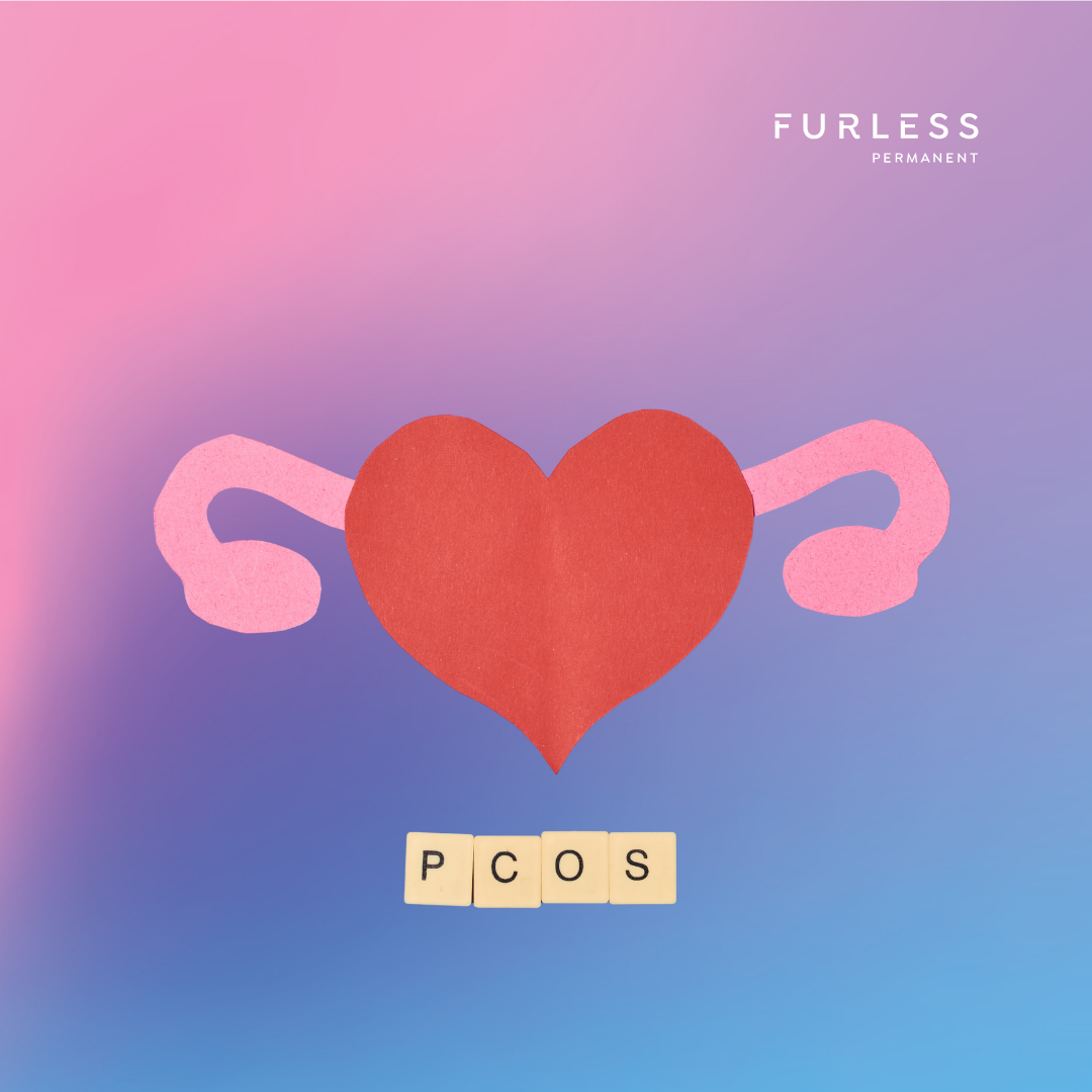 PCOS: Electrolysis to the Rescue